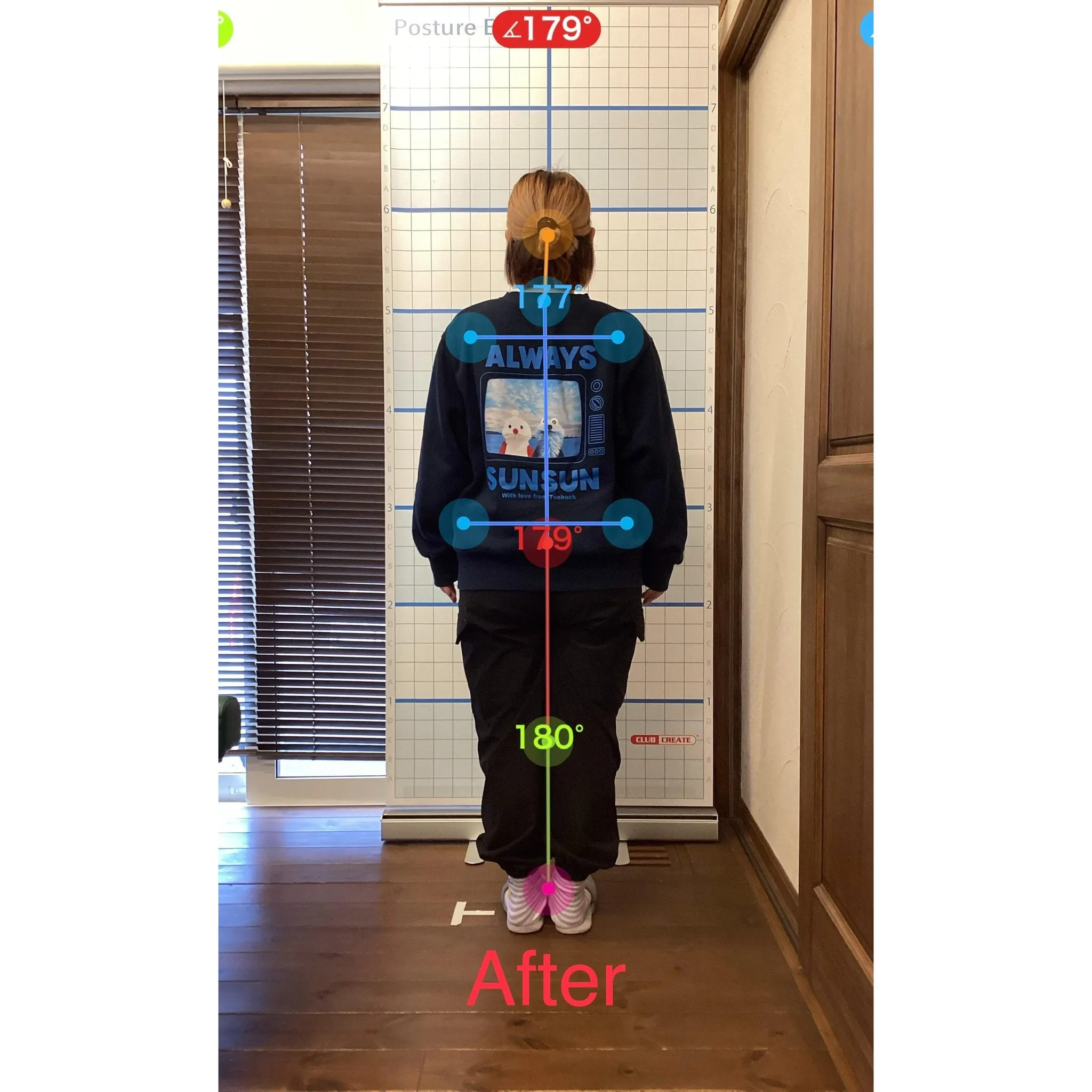 【富里 整体】坐骨神経痛、腰痛、肩こり 他/30代女性/主婦