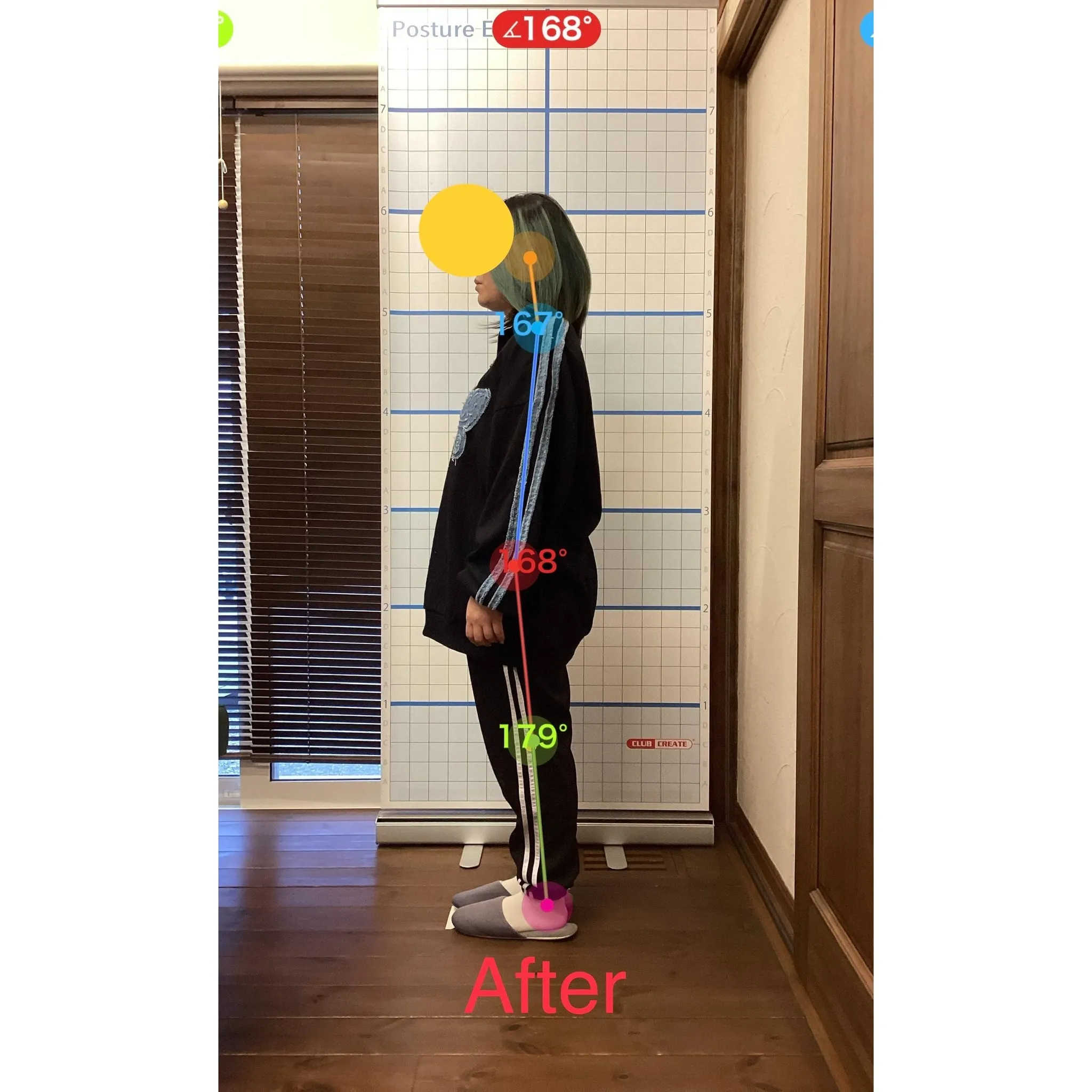 【富里 整体】頭痛、首の痛み、肩こり 他/30代女性/ネイリ...