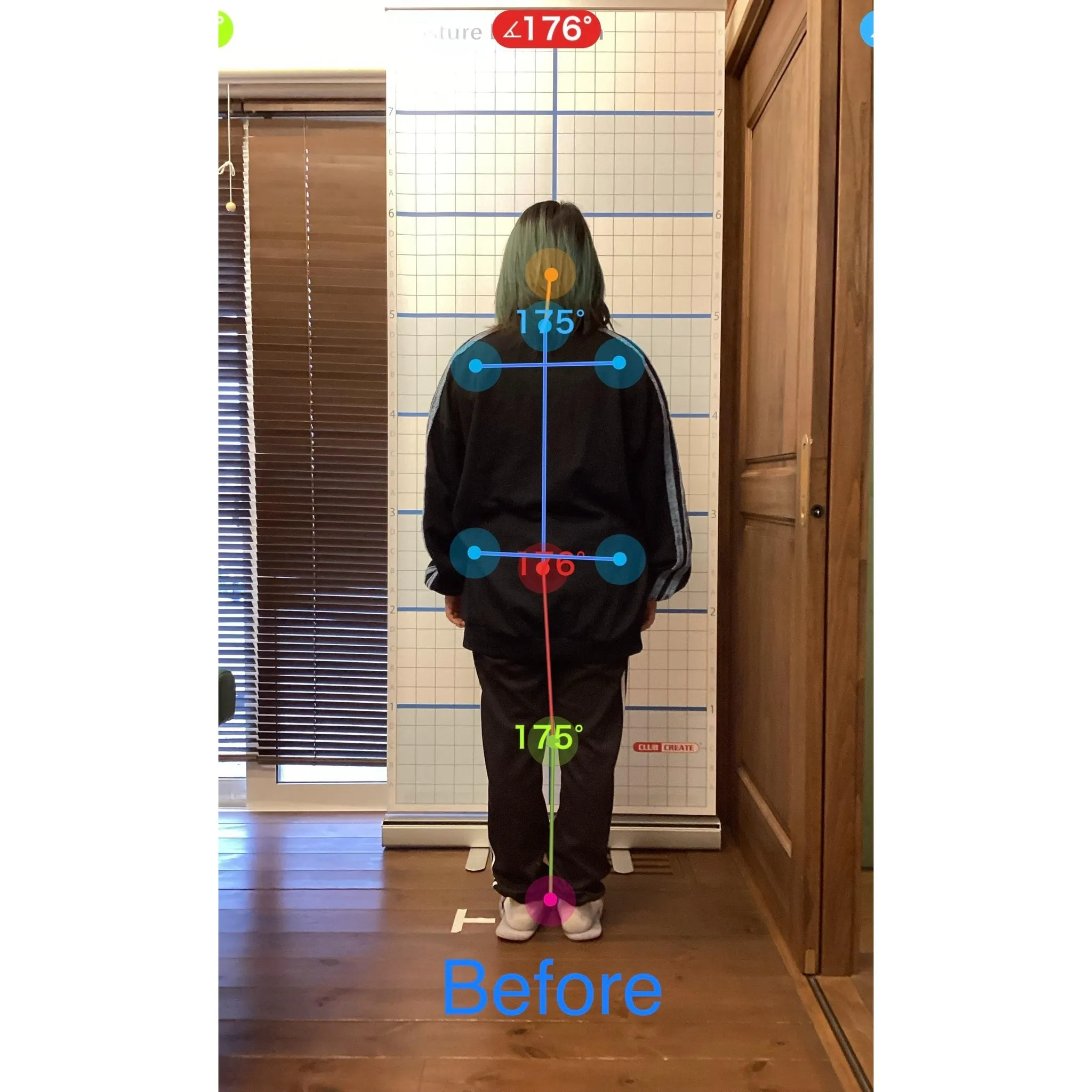 【富里 整体】頭痛、首の痛み、肩こり 他/30代女性/ネイリ...