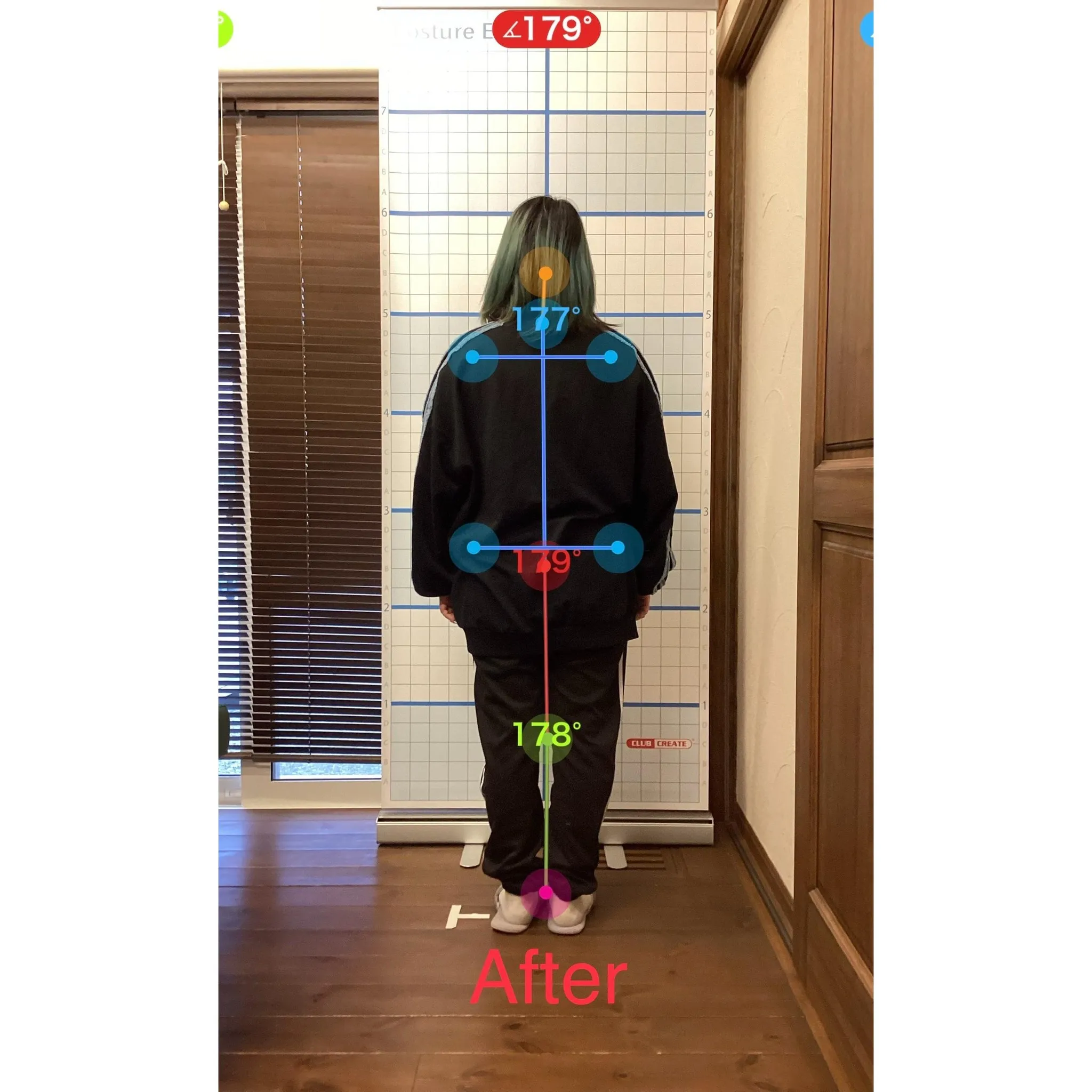 【富里 整体】頭痛、首の痛み、肩こり 他/30代女性/ネイリ...