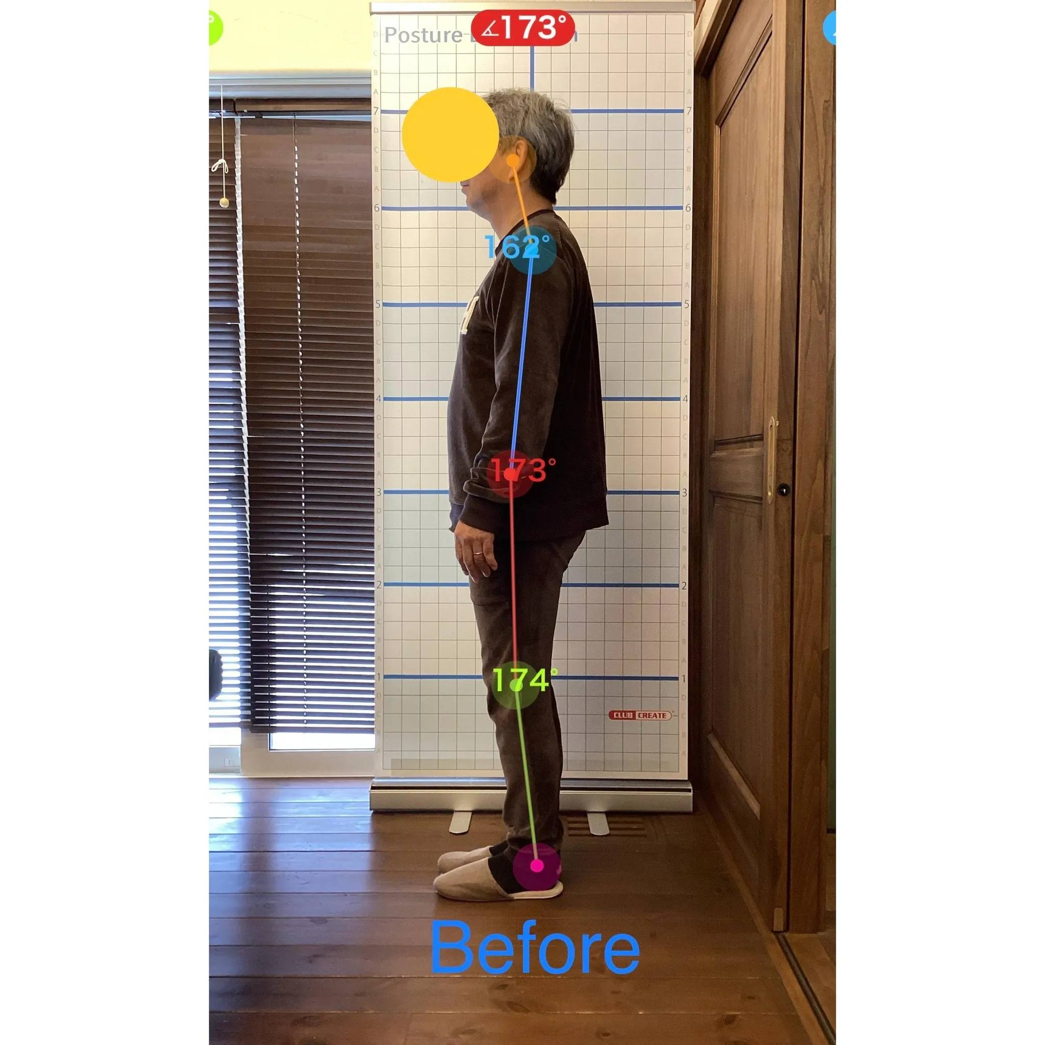 【富里 整体】ぎっくり腰、慢性腰痛、臀部の痛み 他/50代男...