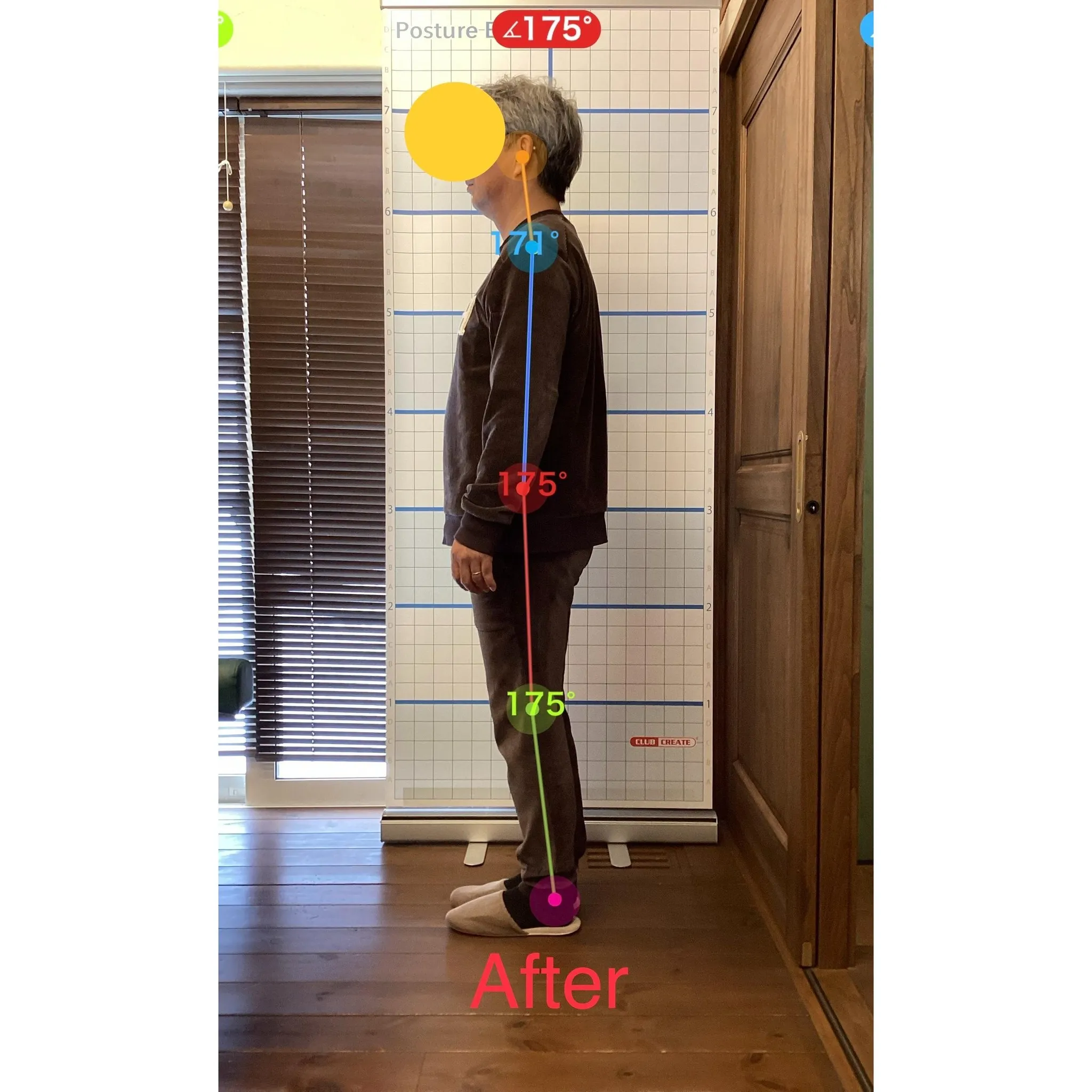 【富里 整体】ぎっくり腰、慢性腰痛、臀部の痛み 他/50代男...