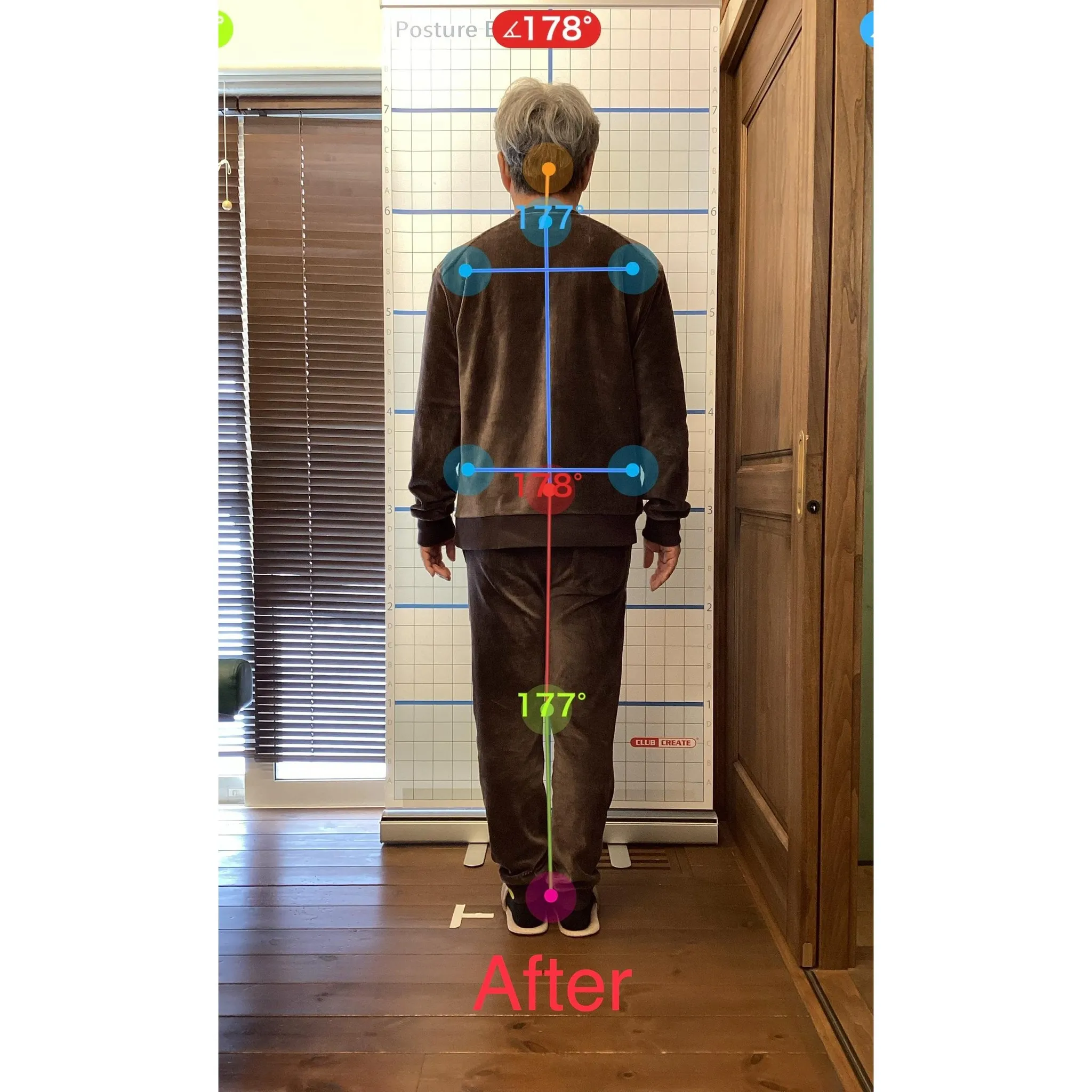 【富里 整体】ぎっくり腰、慢性腰痛、臀部の痛み 他/50代男...