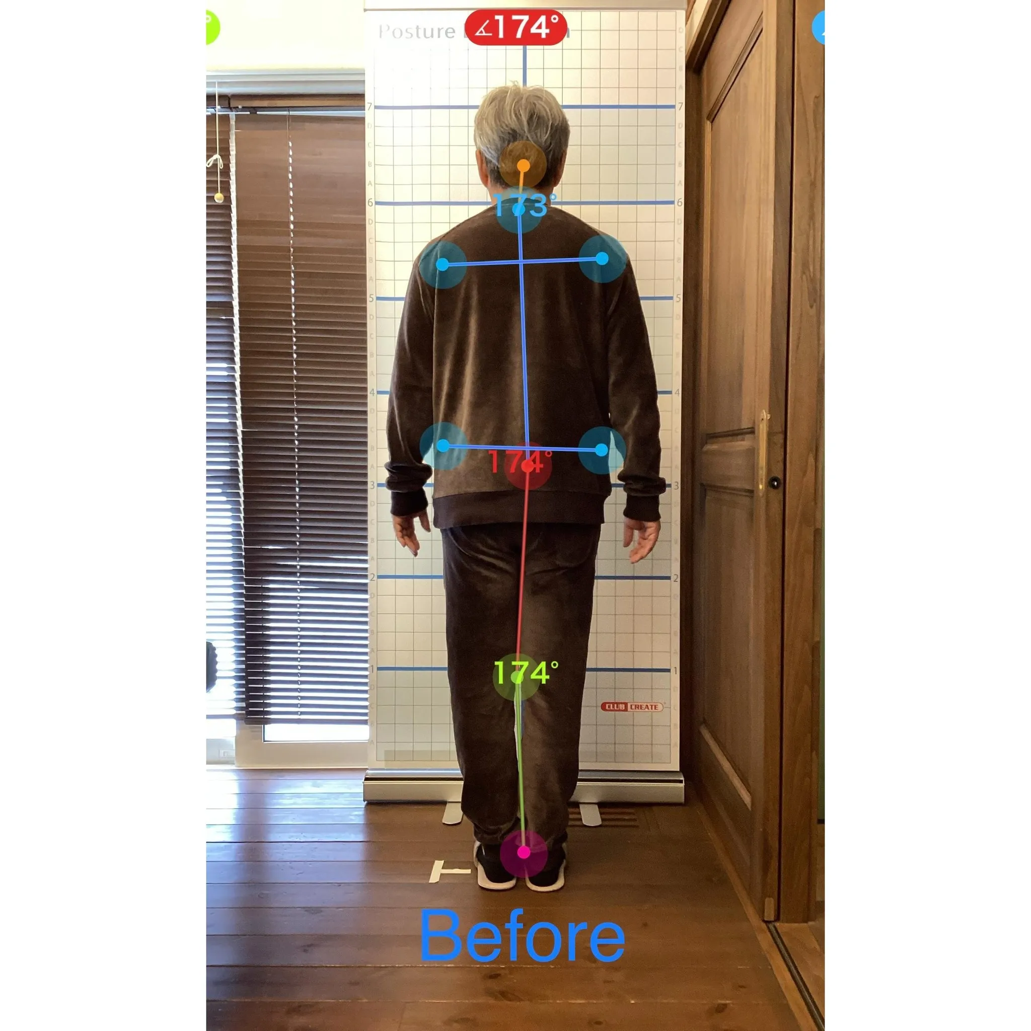 【富里 整体】ぎっくり腰、慢性腰痛、臀部の痛み 他/50代男...