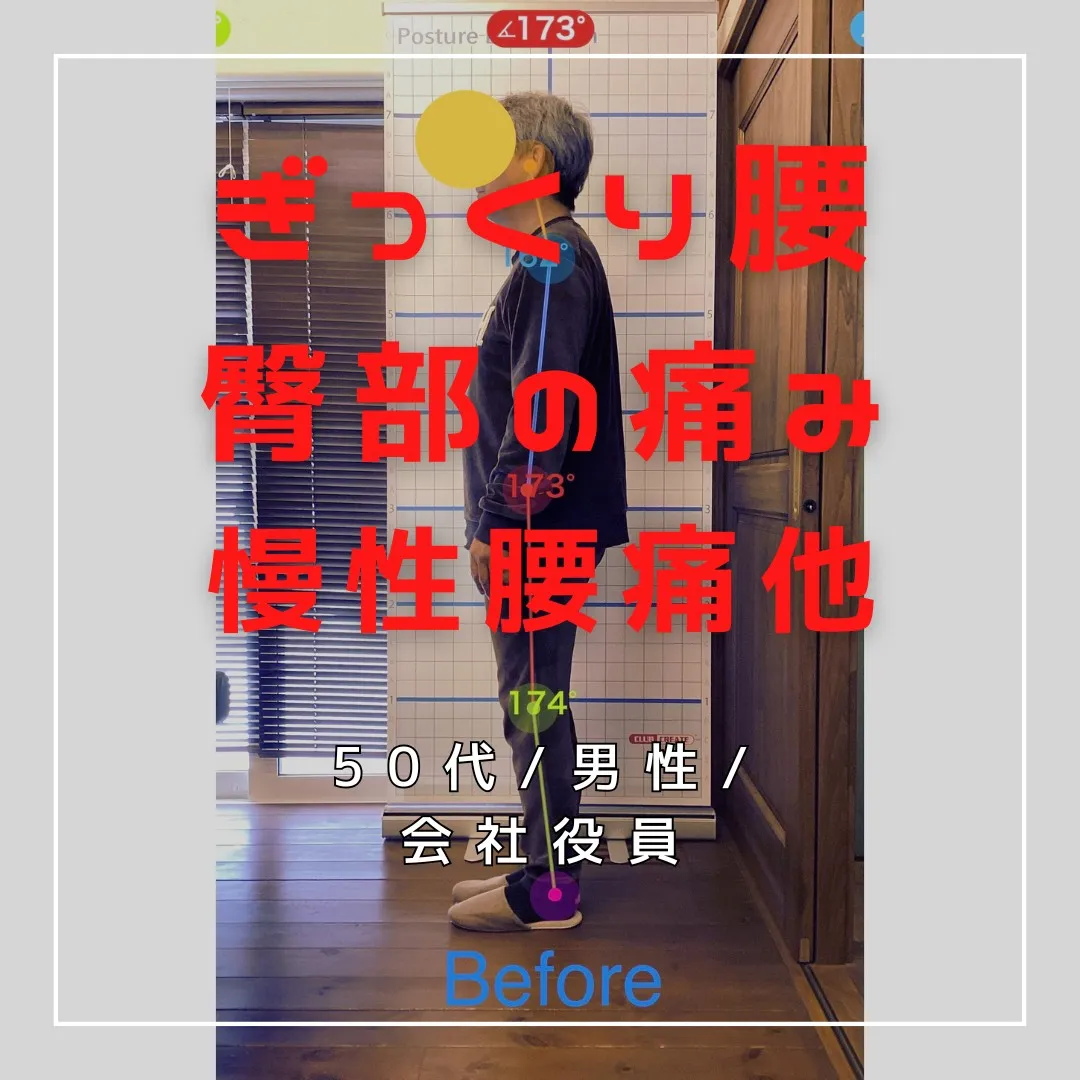 【富里 整体】ぎっくり腰、慢性腰痛、臀部の痛み 他/50代男...