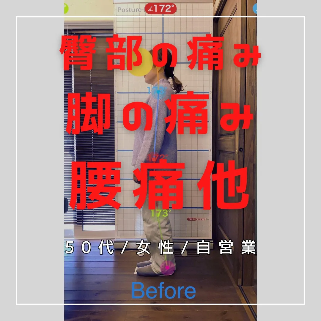 【富里 整体】腰痛、臀部の痛み、脚の痛み 他/50代女性/自...