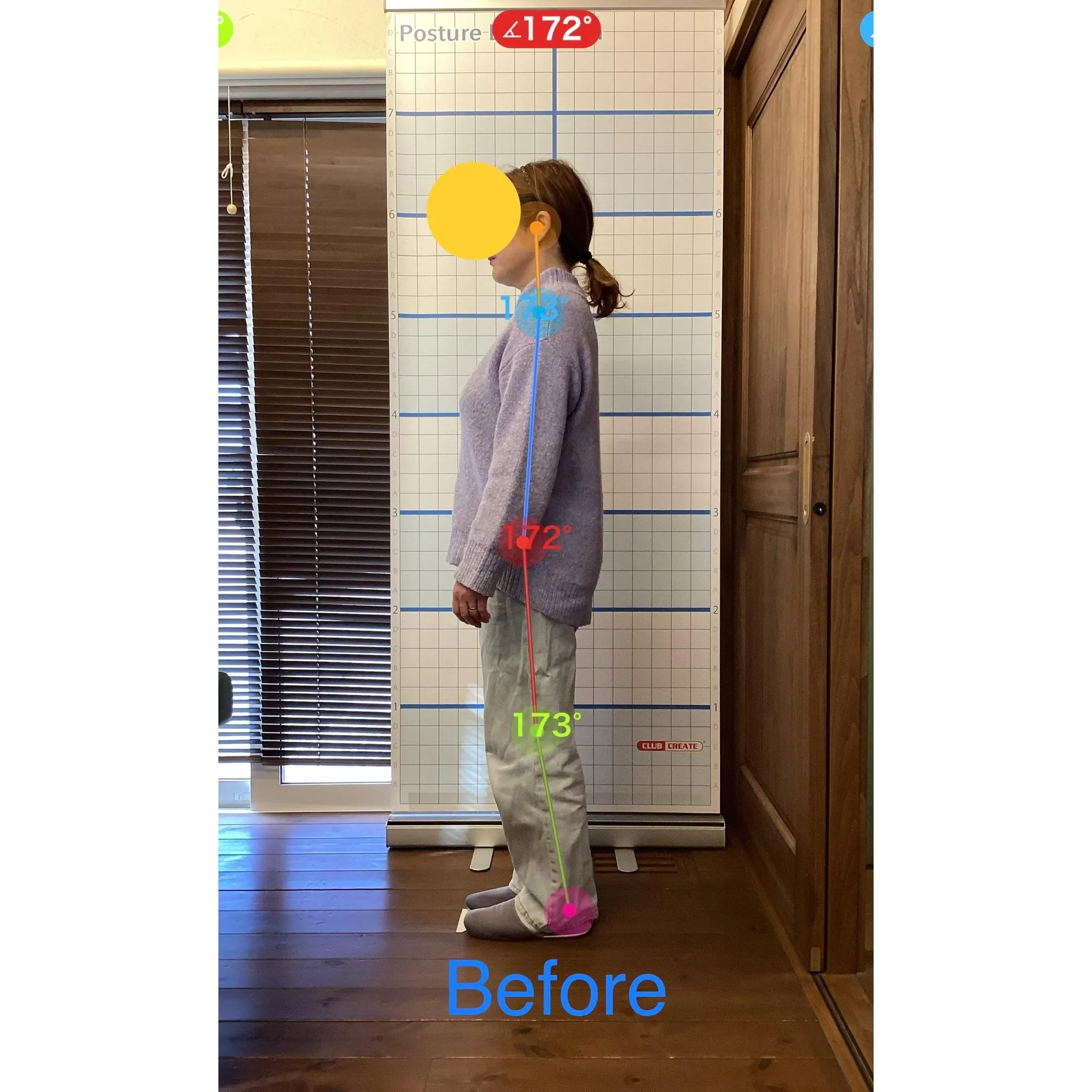 【富里 整体】腰痛、臀部の痛み、脚の痛み 他/50代女性/自...