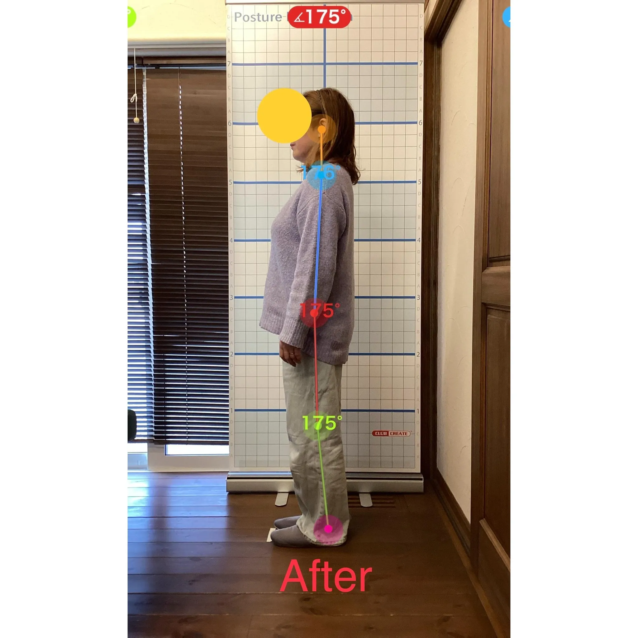 【富里 整体】腰痛、臀部の痛み、脚の痛み 他/50代女性/自...