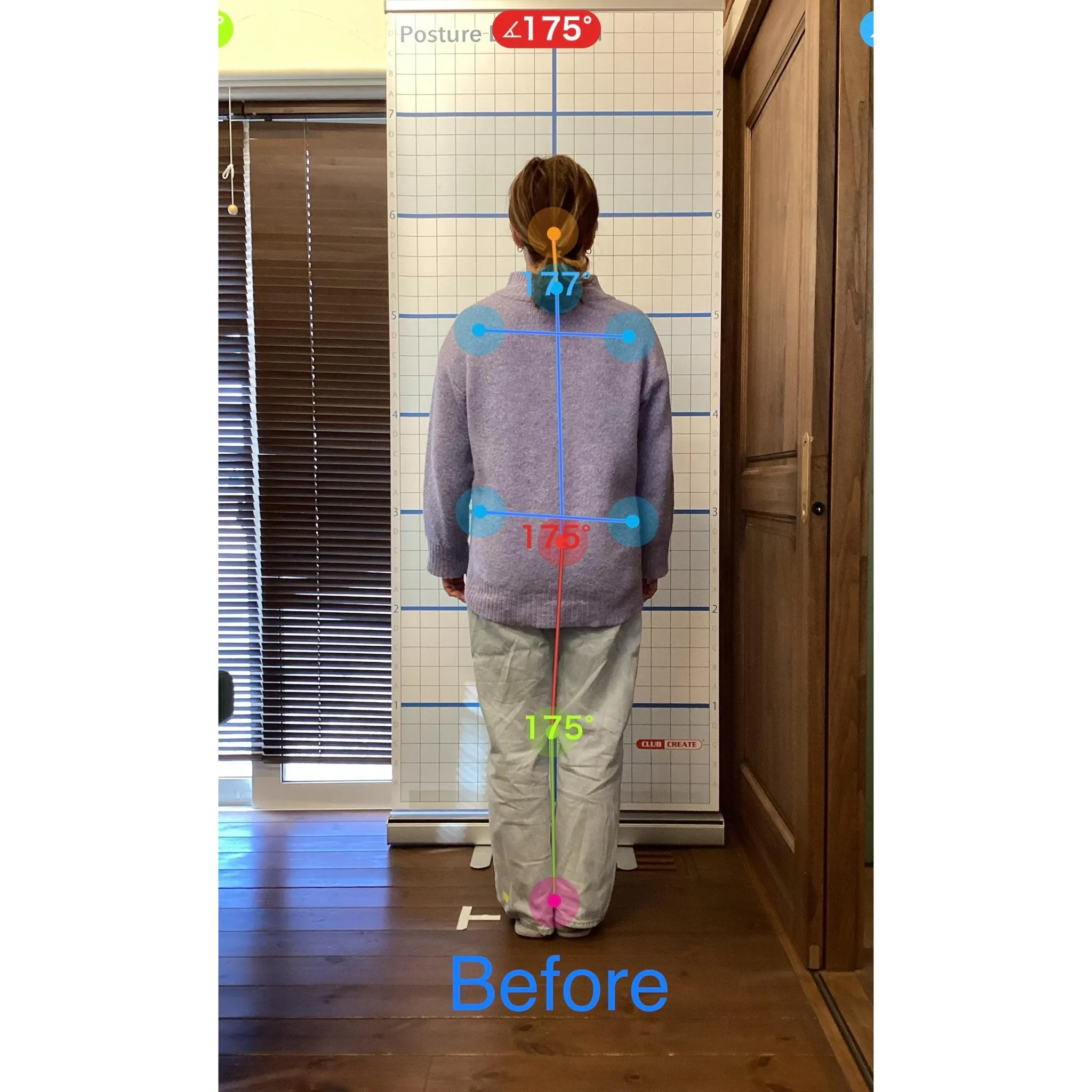 【富里 整体】腰痛、臀部の痛み、脚の痛み 他/50代女性/自...