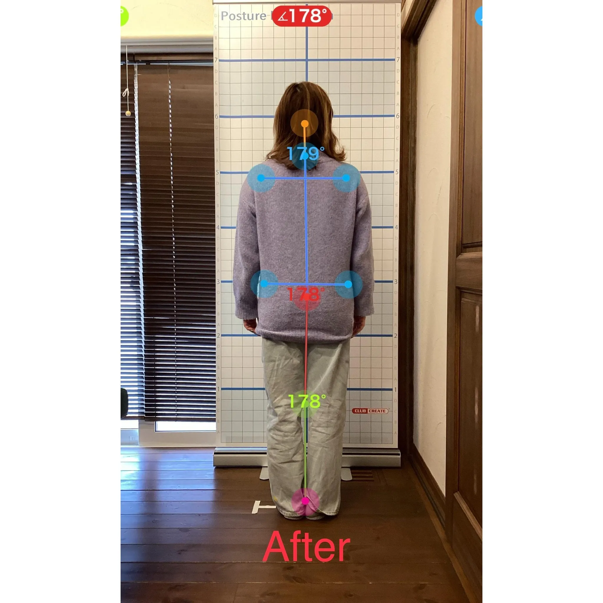 【富里 整体】腰痛、臀部の痛み、脚の痛み 他/50代女性/自...