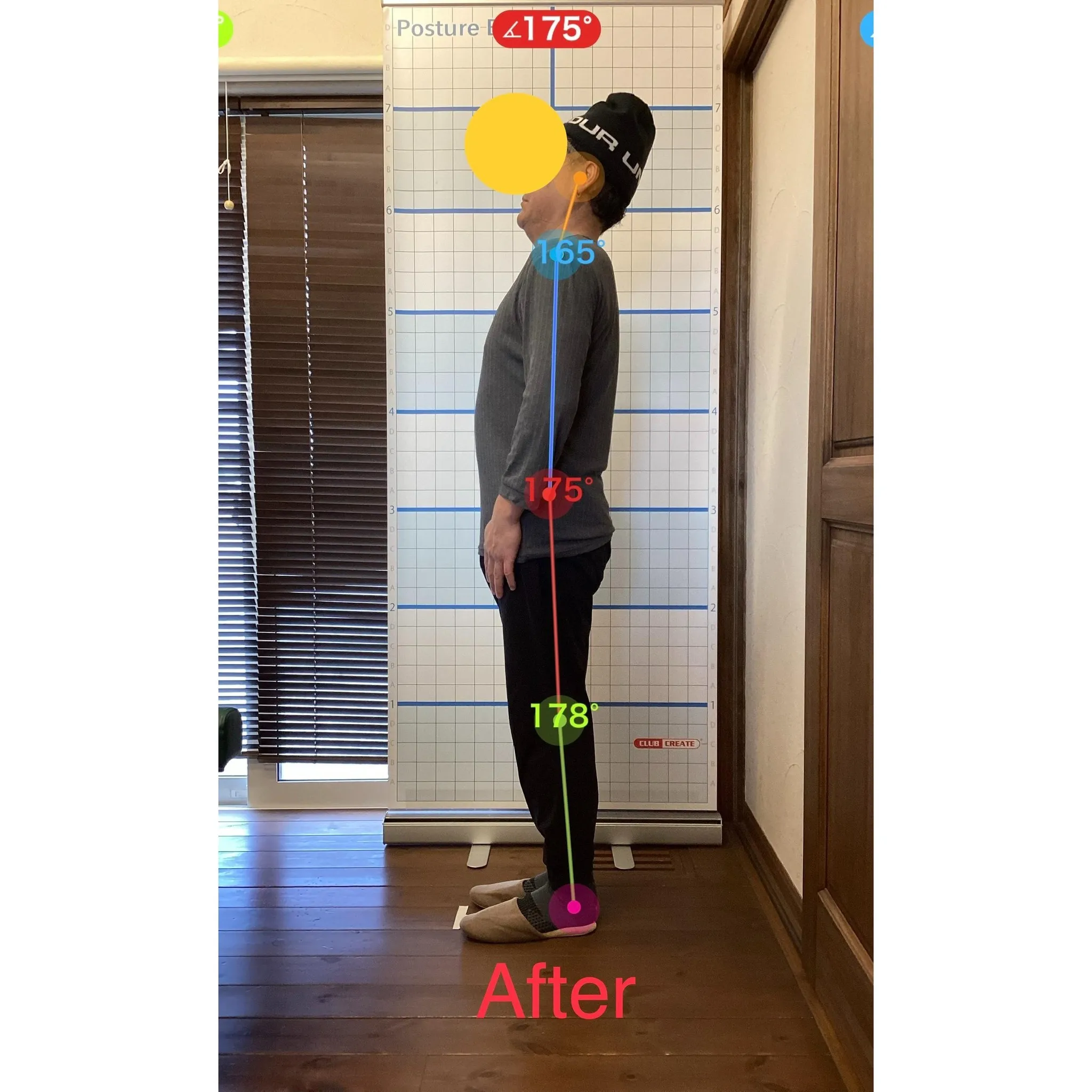 【富里 整体】巻き肩、脚の付け根の痛み、腰痛 他/50代男性...