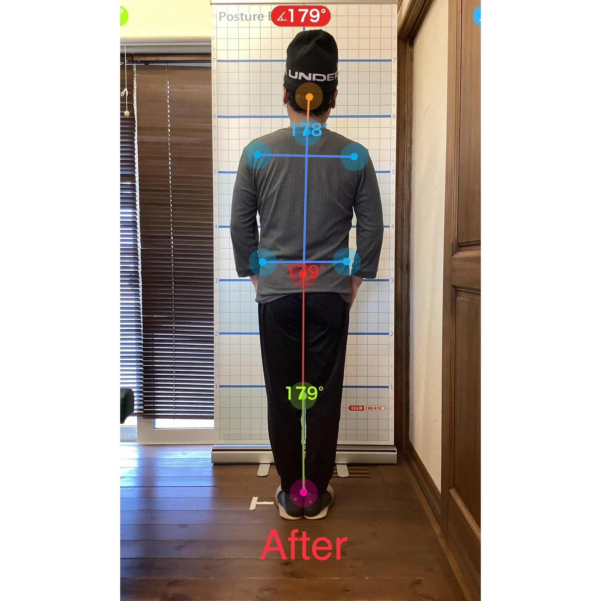 【富里 整体】巻き肩、脚の付け根の痛み、腰痛 他/50代男性...
