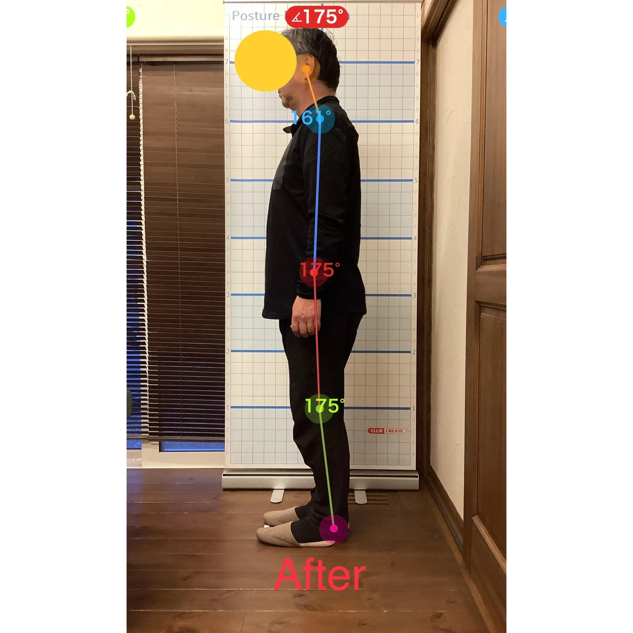 【富里 整体】ぎっくり腰、腰痛、高血圧 他/50代男性/会社...