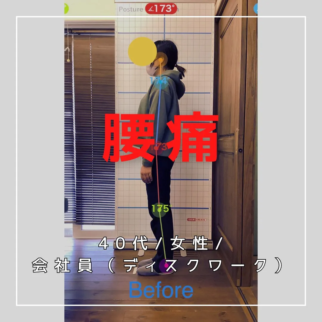 【富里 整体】腰痛/40代女性/会社員（ディスクワーク）