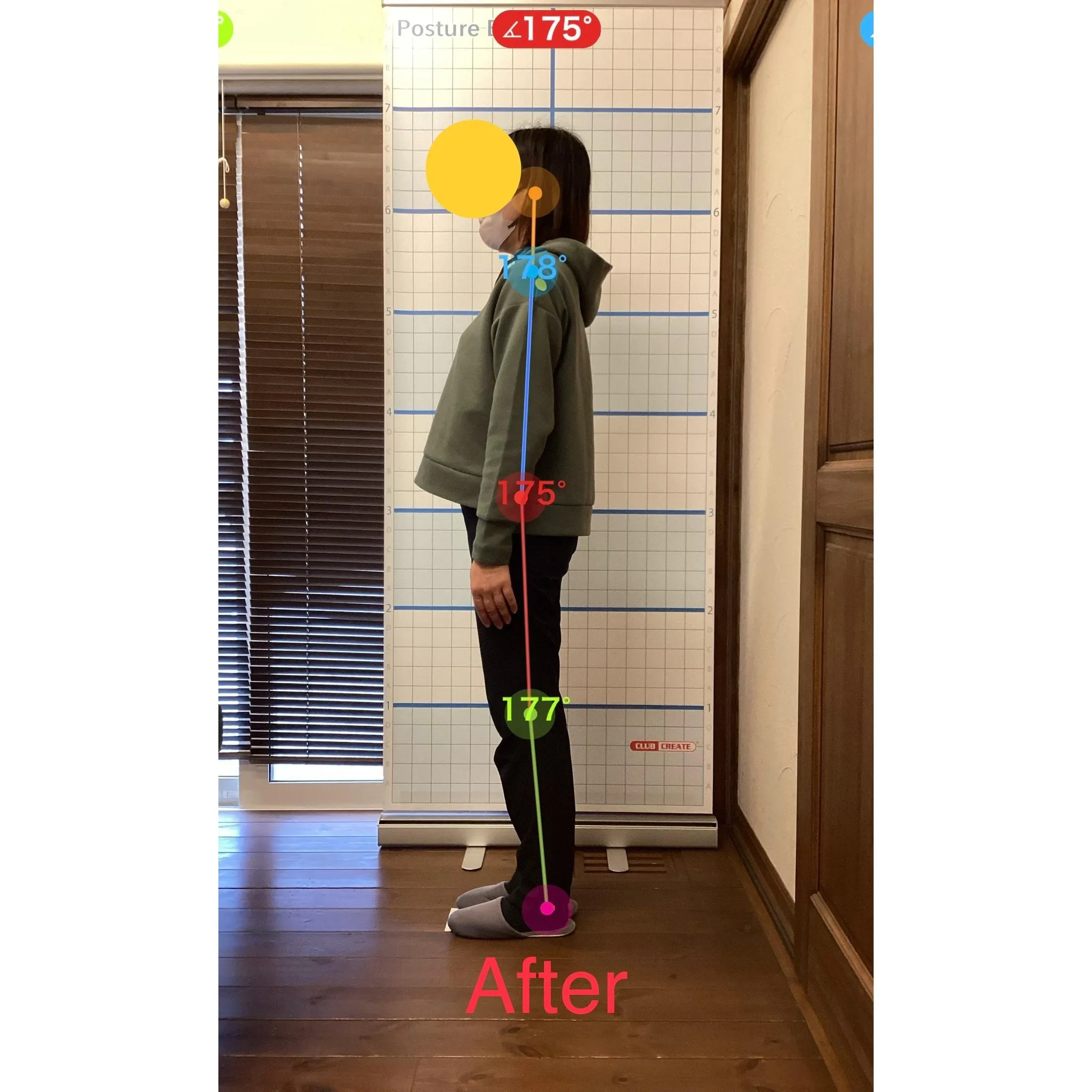 【富里 整体】腰痛/40代女性/会社員（ディスクワーク）