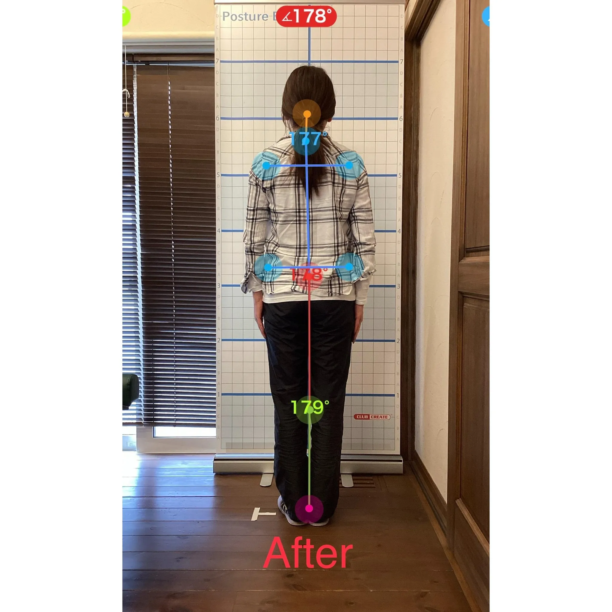 【富里 整体】肩こり、腰痛、猫背 他/50代女性/会社員（事...