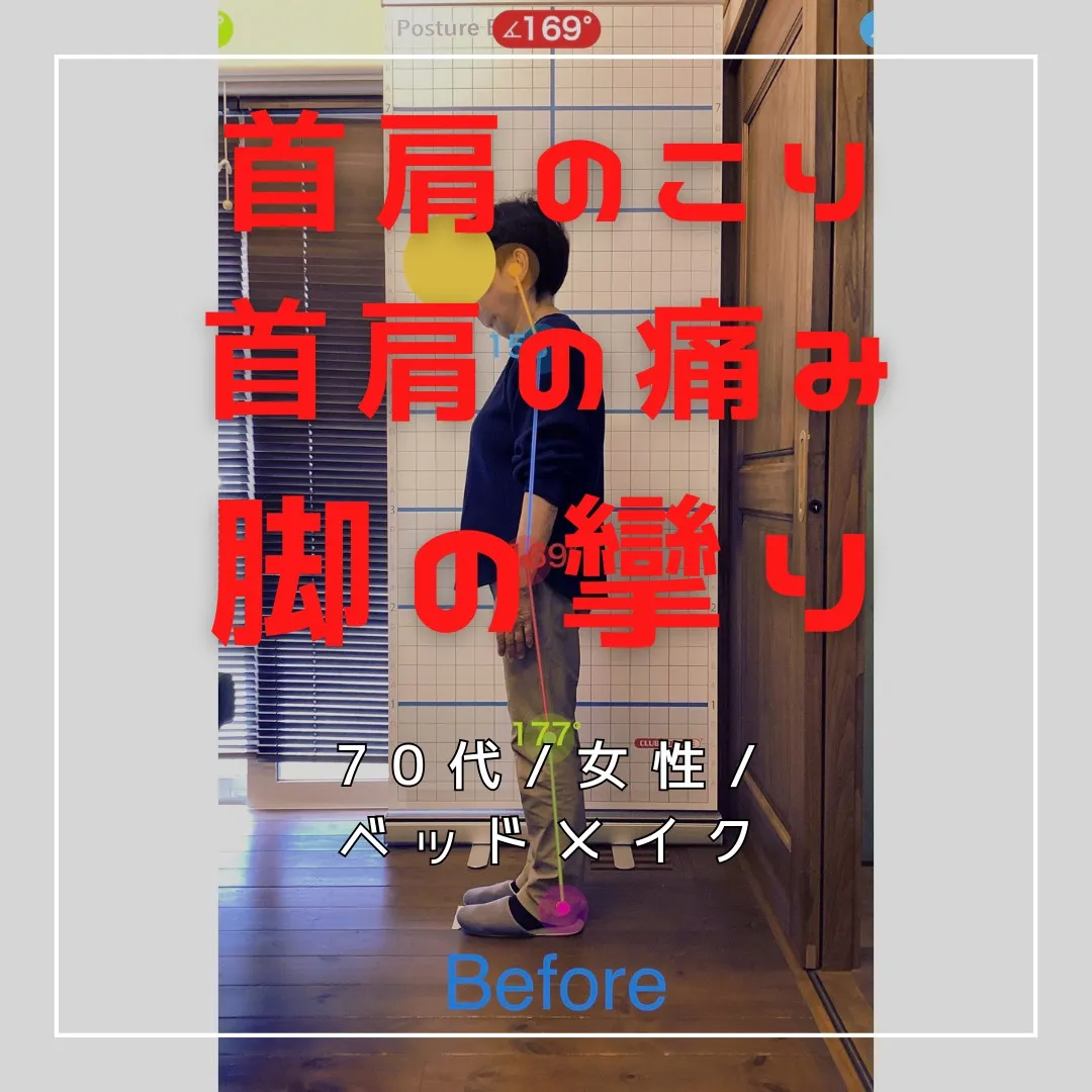 【富里 整体】首肩のコリ、首肩の痛み、脚の攣り 他/70代女...