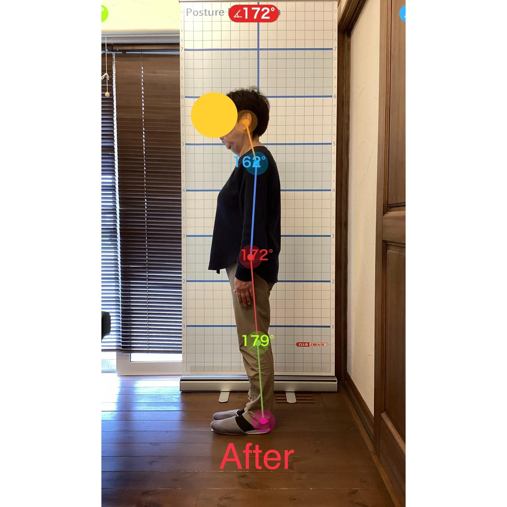 【富里 整体】首肩のコリ、首肩の痛み、脚の攣り 他/70代女...