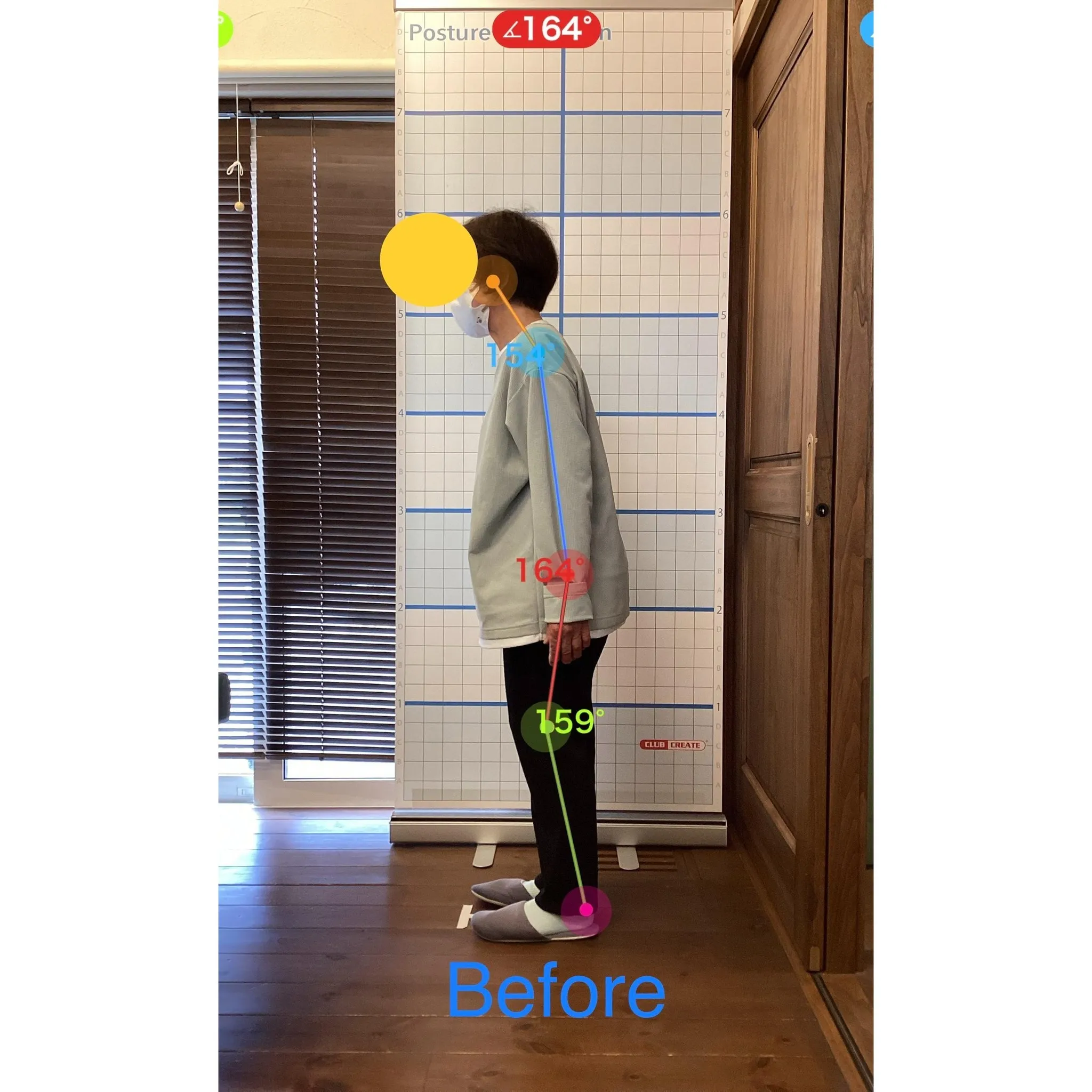 【富里 整体】坐骨神経痛、臀部の痛み、肩こり 他/60代女性...