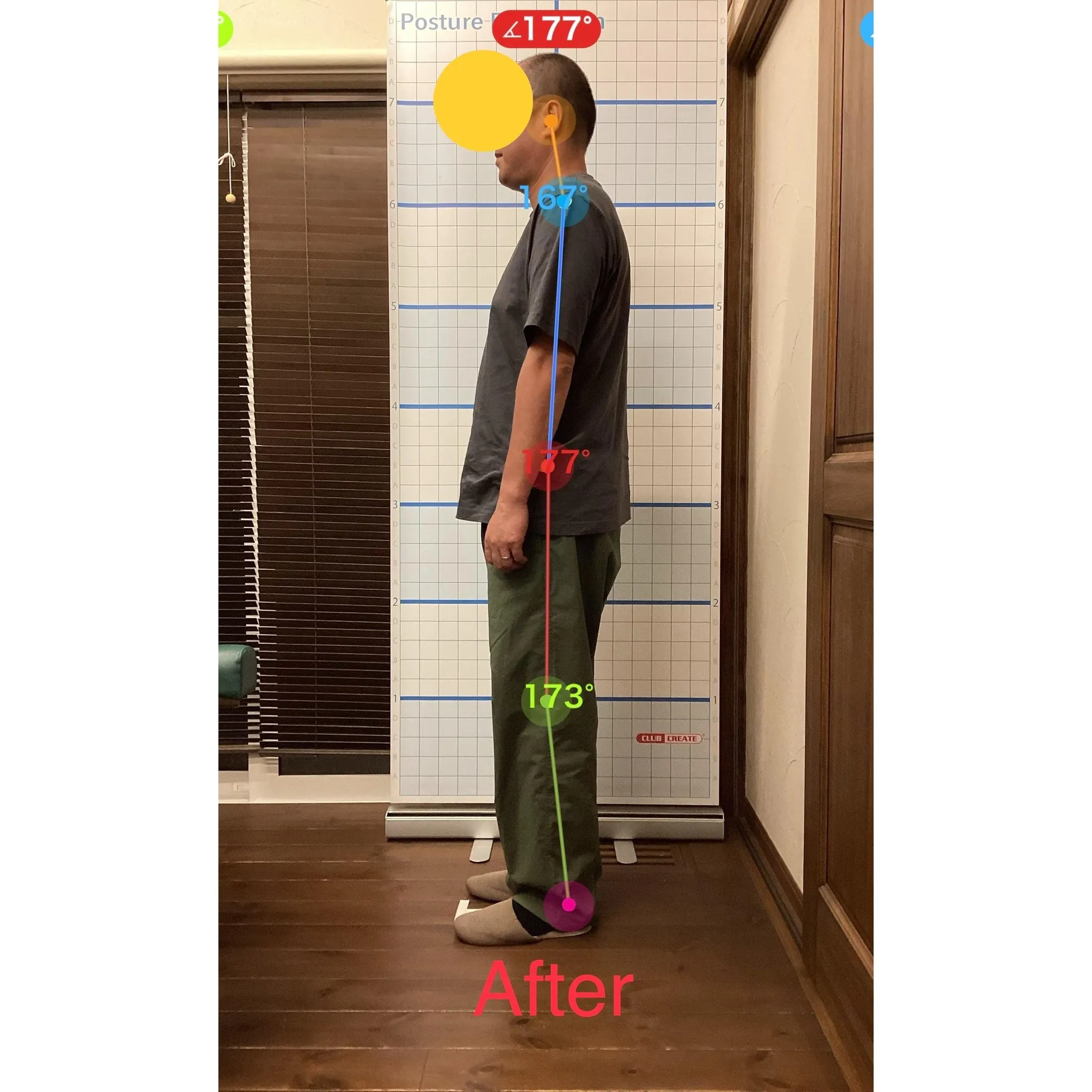 【富里 整体】腰痛、胸の痛み、背中の痛み 他/50代男性/公...
