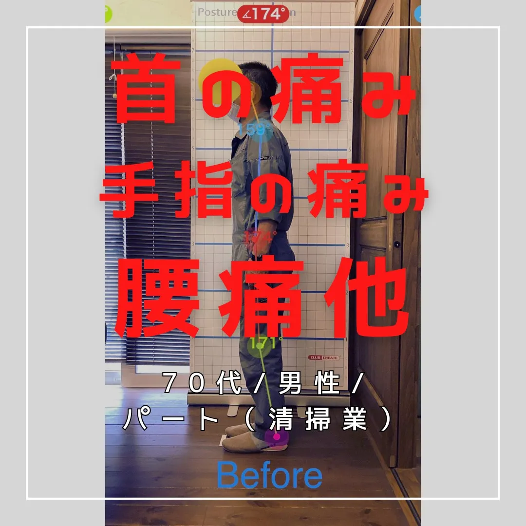 【富里 整体】腰痛、首の痛み、手指の痛み 他/70代男性/パ...