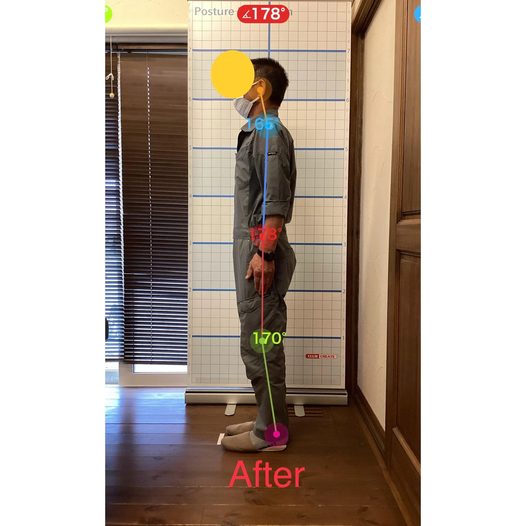 【富里 整体】腰痛、首の痛み、手指の痛み 他/70代男性/パ...