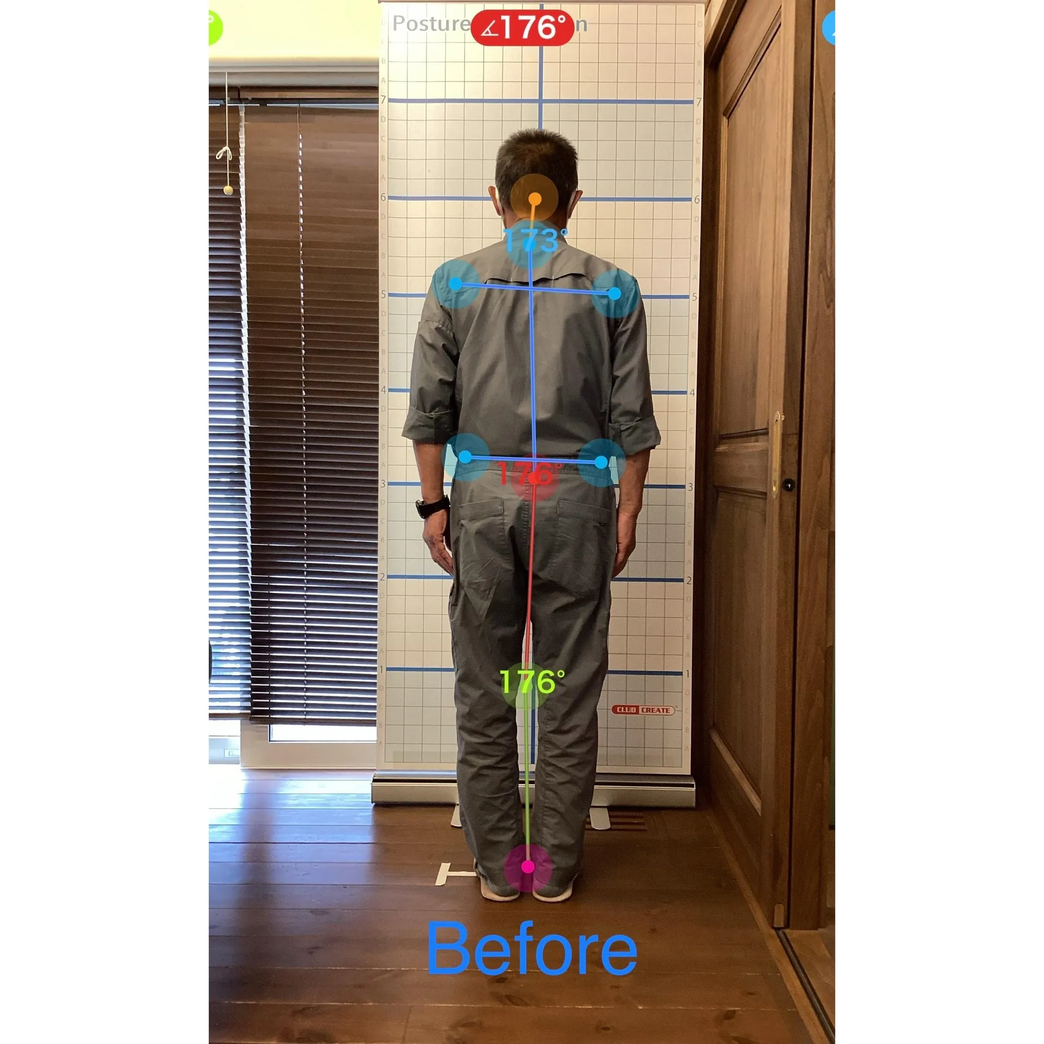 【富里 整体】腰痛、首の痛み、手指の痛み 他/70代男性/パ...