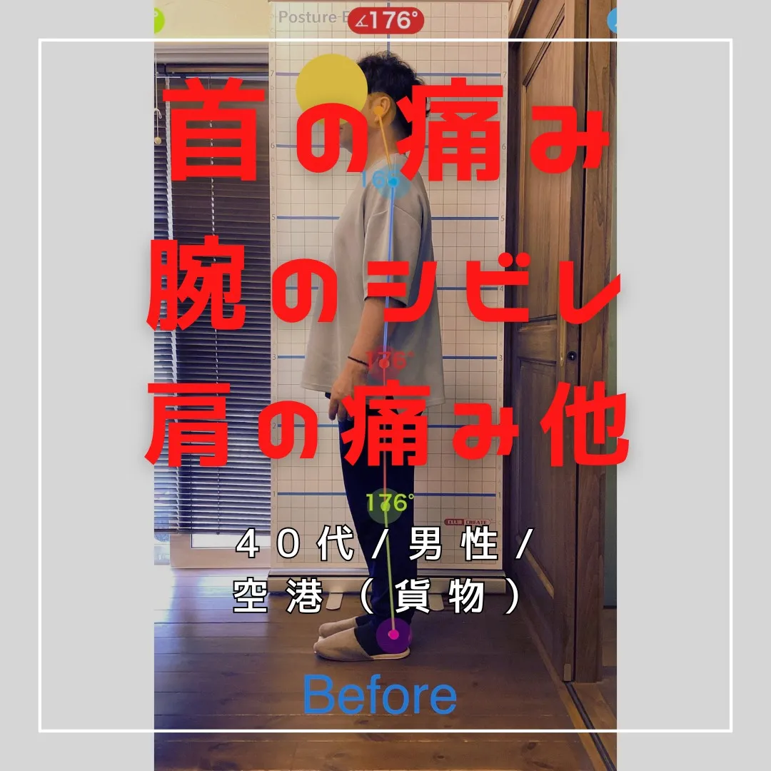 【富里 整体】首の痛み、肩の痛み、腕のシビレ 他/40代男性...