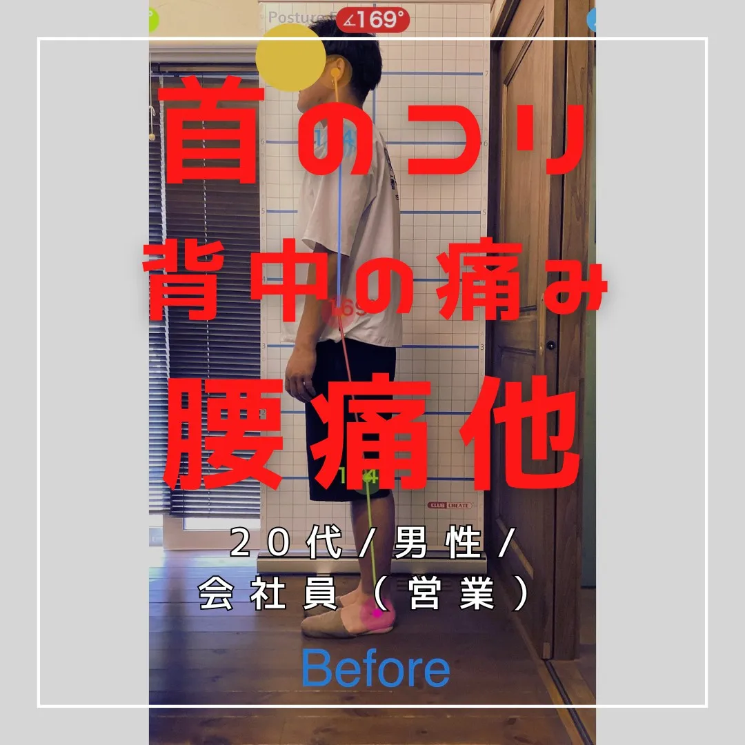 【富里 整体】腰痛、背中の痛み、首のコリ 他/20代男性/会...