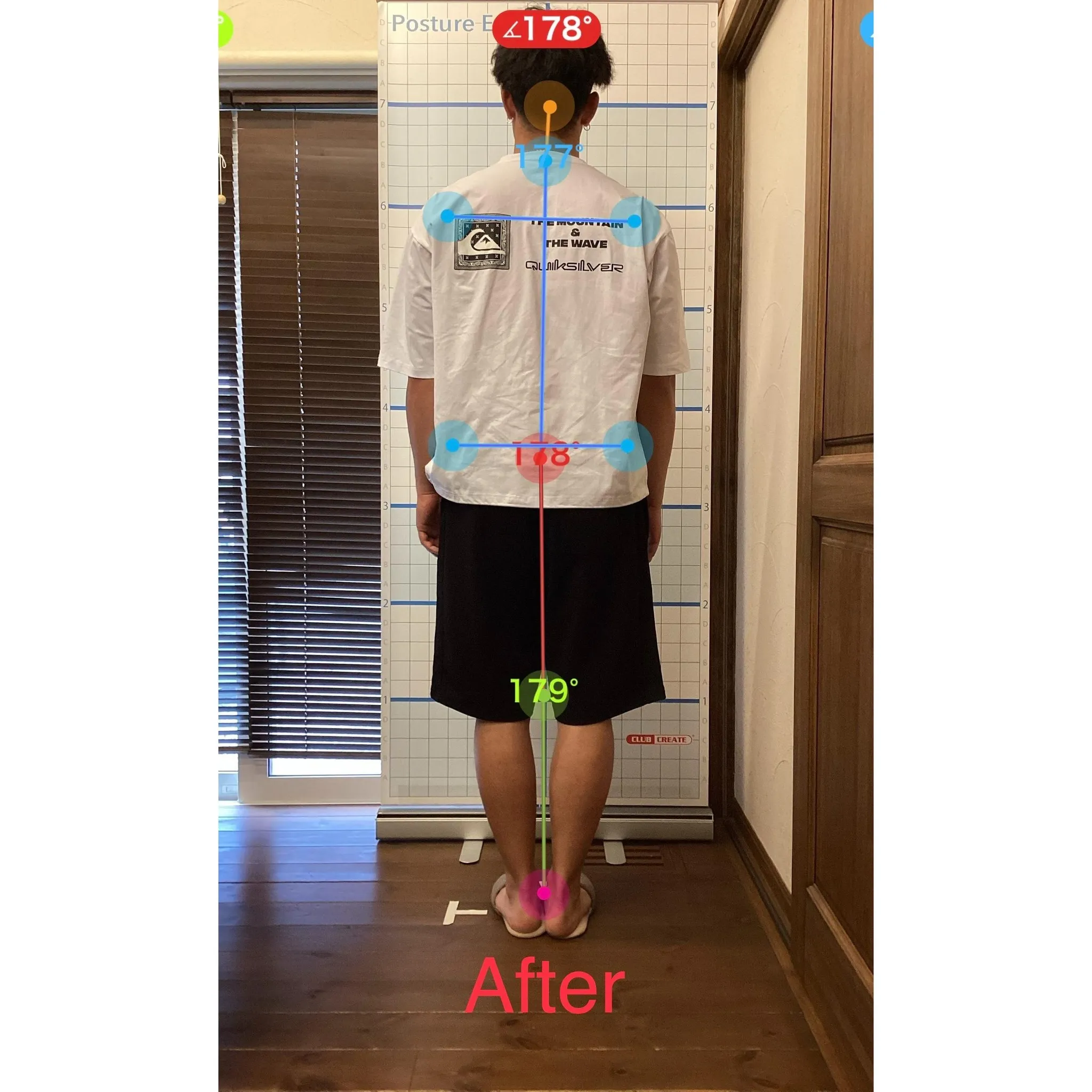 【富里 整体】腰痛、背中の痛み、首のコリ 他/20代男性/会...