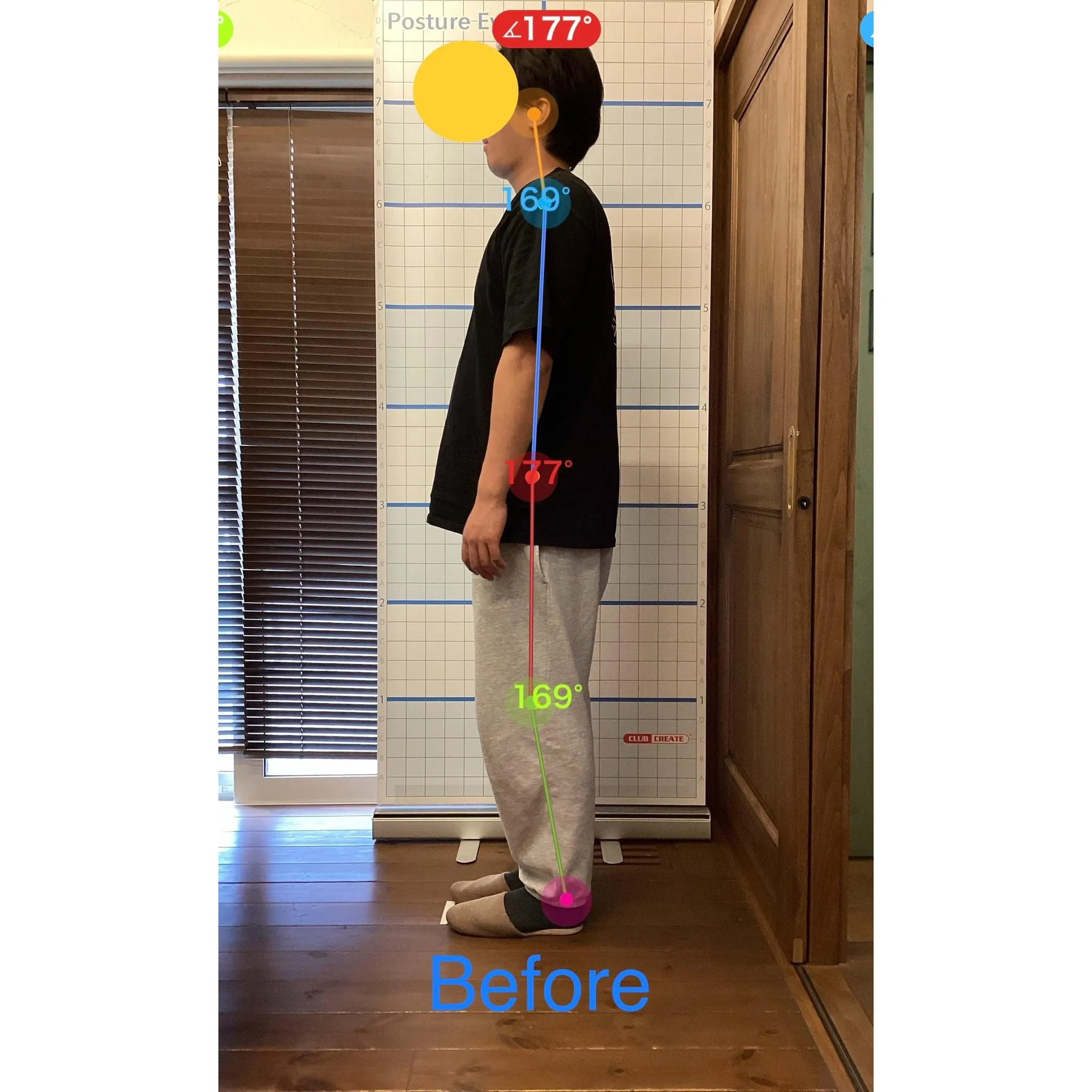 【富里 整体】肩こり、猫背、腰痛 他/20代男性/会社員(営...
