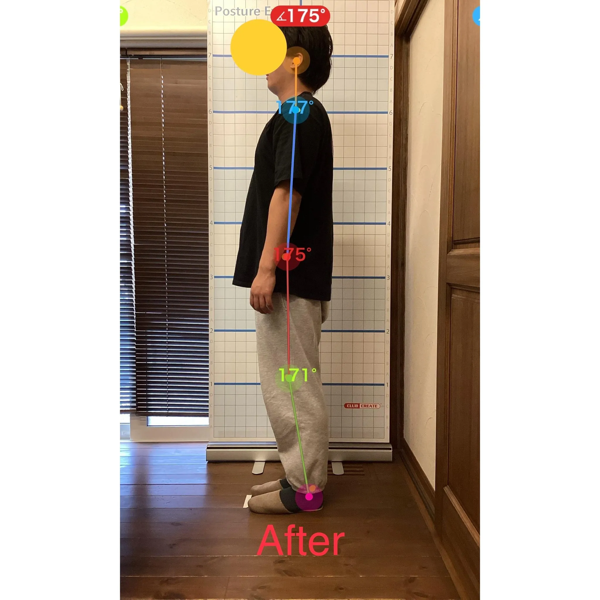 【富里 整体】肩こり、猫背、腰痛 他/20代男性/会社員(営...