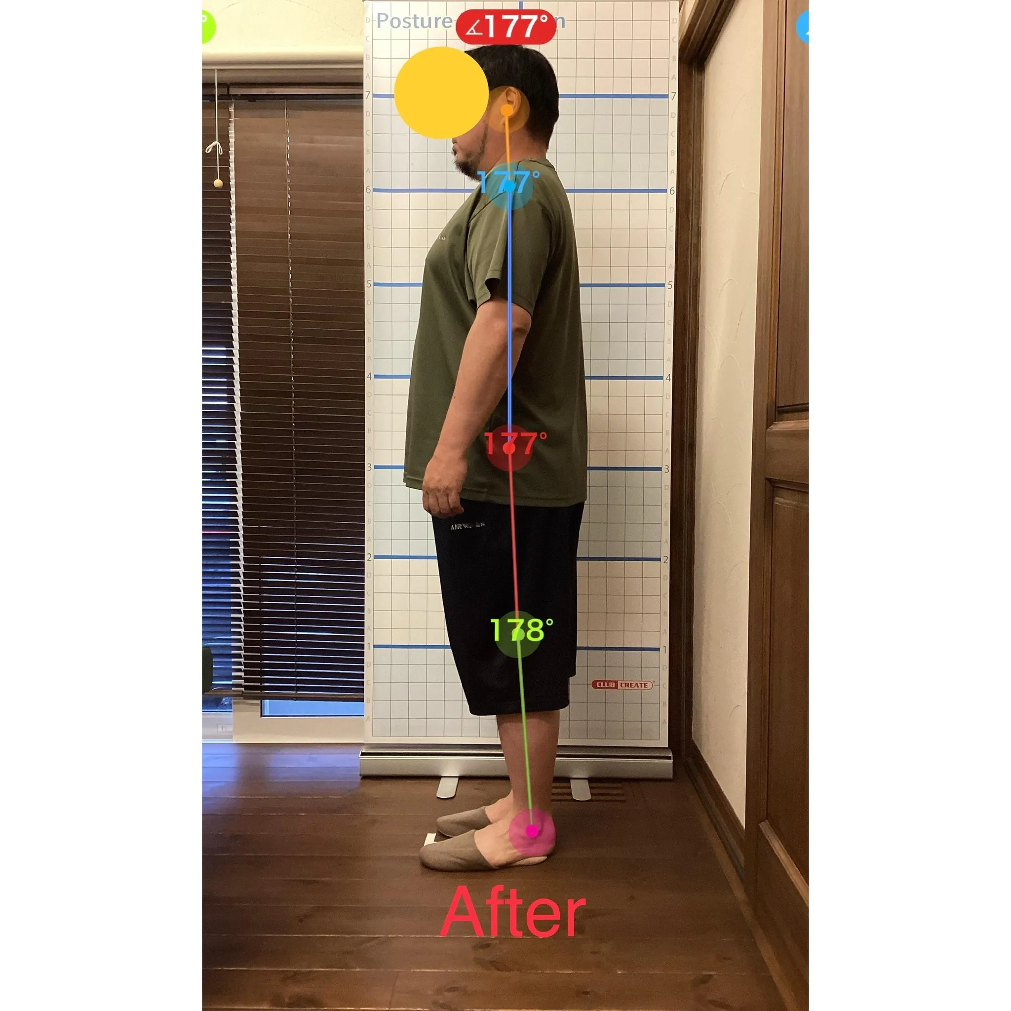 【富里 整体】首こり、肩こり、腕の痛み 他/50代男性/建設...